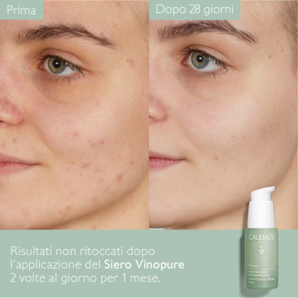 CAUDALIE - VINOPURE Siero Salicilico Anti-imperfezioni - immagine 2