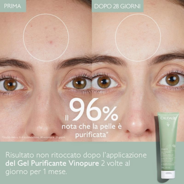 CAUDALIE - VINOPURE Gel Detergente Purificante 150ML - immagine 2