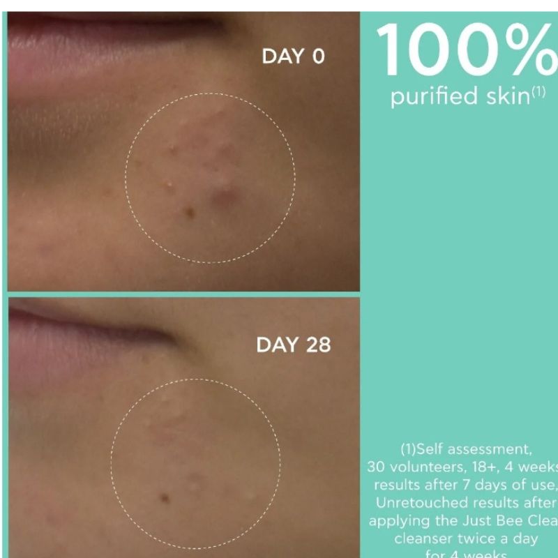 APIVITA-JUST BEE CLEAR Gel Detergente Purificante - immagine 3