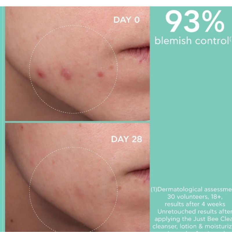 APIVITA-JUST BEE CLEAR Gel Detergente Purificante - immagine 4